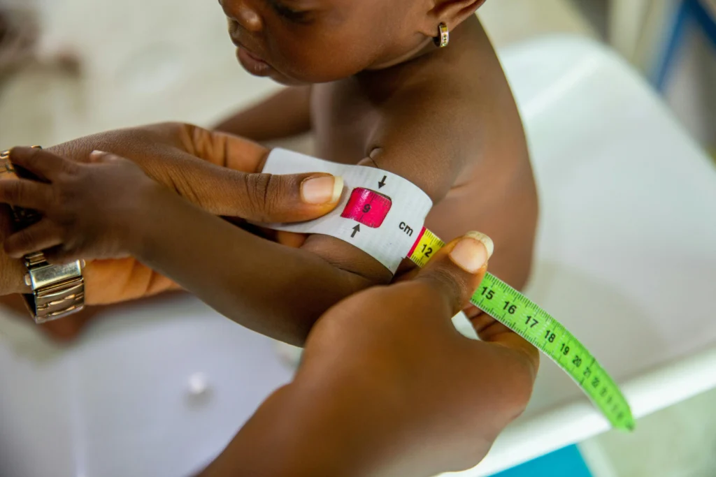 Understanding of Malnutrition: A Global Health Challenge 3 Understanding Malnutrition: A Global Health Challenge